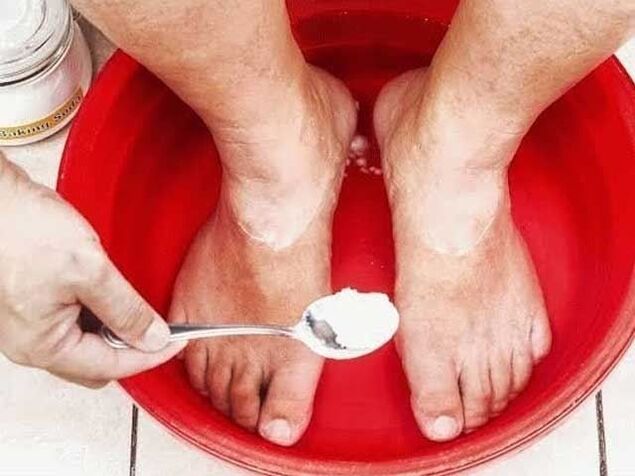 sodas vannas pret sēnītēm