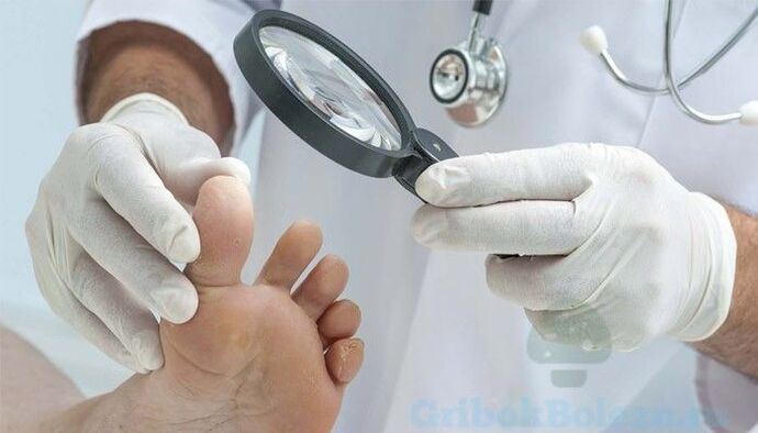 pēdu sēnīšu diagnostika, ko veic ārsts