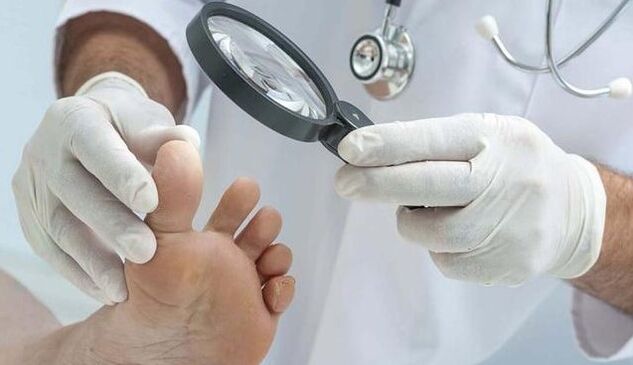 Sēnīšu diagnostika